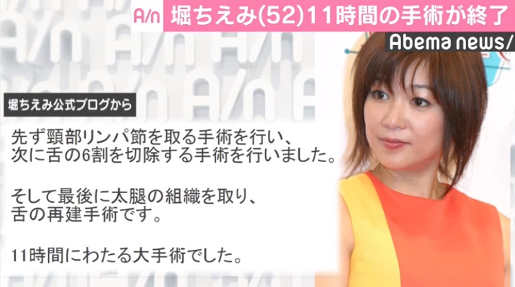 「手術後はICUに入り、今はゆっくり休んでいます。ICUでは来週月曜日まで集中治療を、行うそうです」と手術後の様子について明かした。